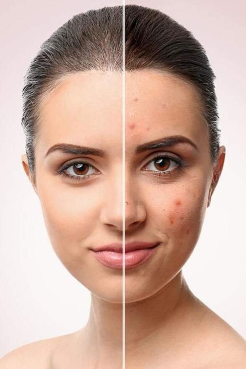 Skin service